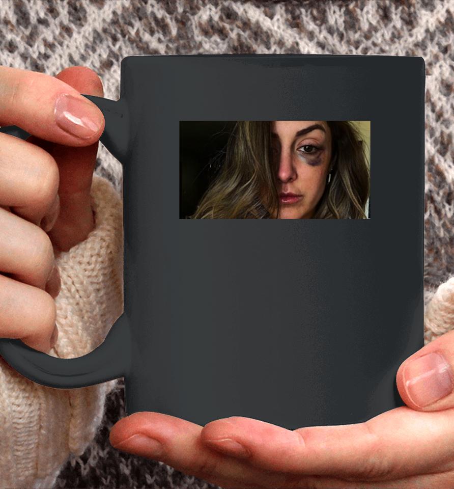 Saraya Bruise Eyes Coffee Mug