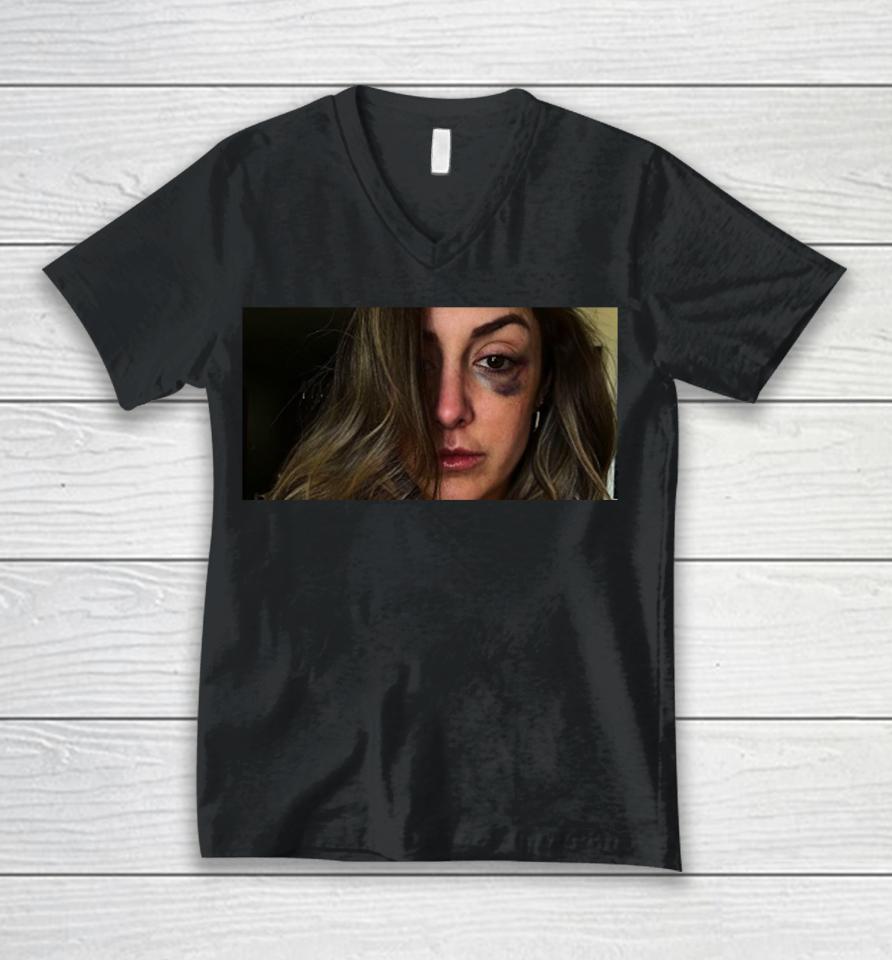 Saraya Bruise Eyes Unisex V-Neck T-Shirt