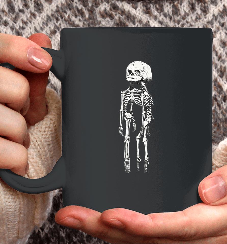 Skeleton Twin Anamoly Coffee Mug