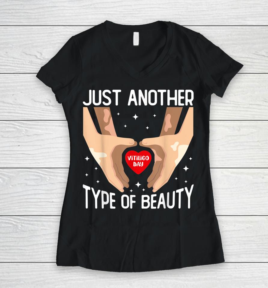 World Vitiligo Day Just Another Type Of Beauty Awareness Women V-Neck T-Shirt