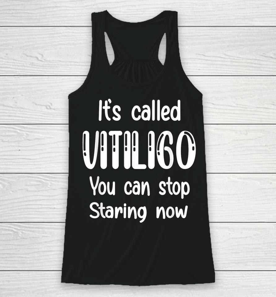 World Vitiligo Day Racerback Tank