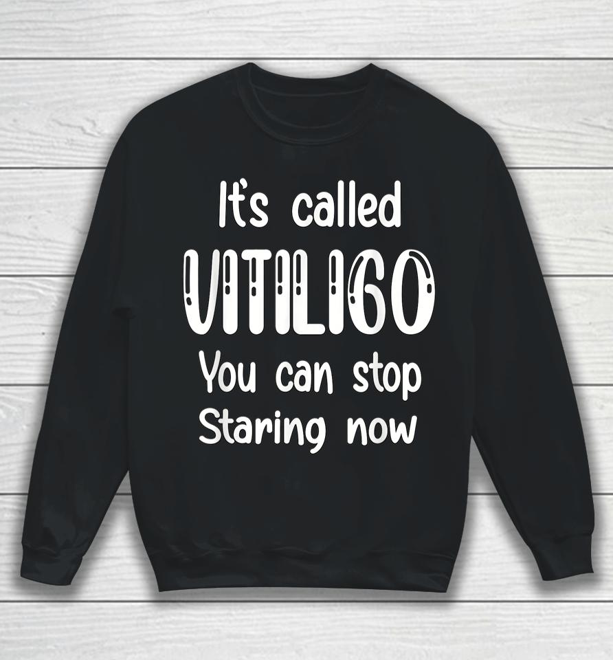 World Vitiligo Day Sweatshirt
