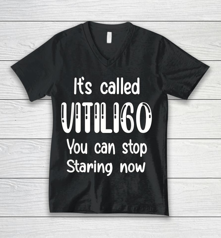 World Vitiligo Day Unisex V-Neck T-Shirt