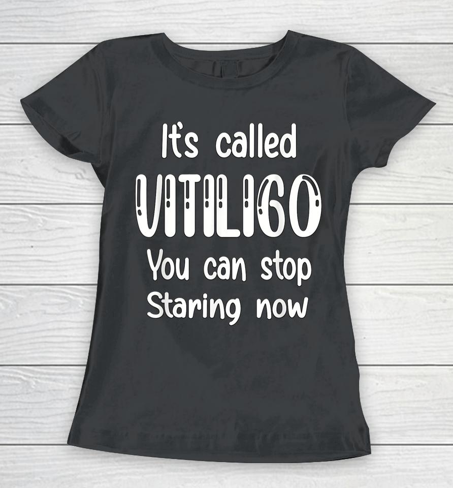World Vitiligo Day Women T-Shirt