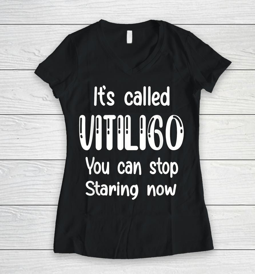 World Vitiligo Day Women V-Neck T-Shirt